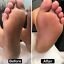 Foot Grinder Foot Dead Skin Remover for Men Women Hard Dry Skin Heel Scrubber